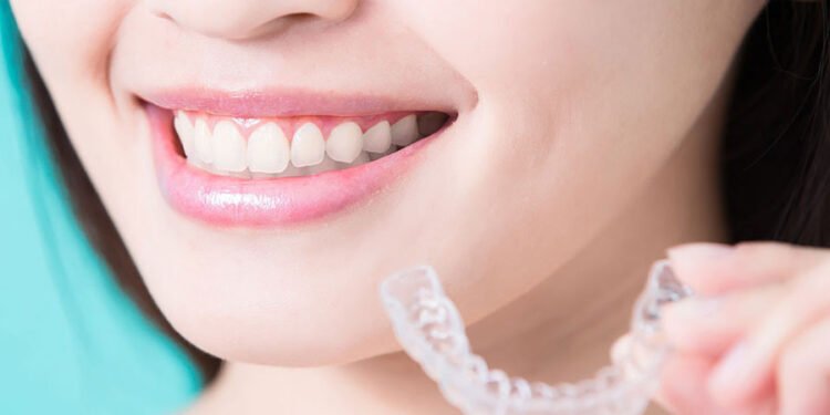 Revealing the Path to a Perfect Smile