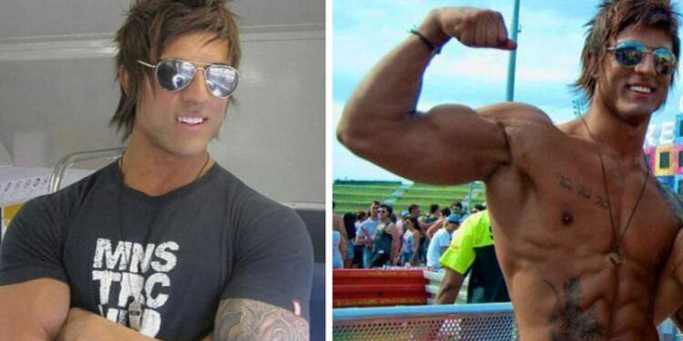 How Did Zyzz Die