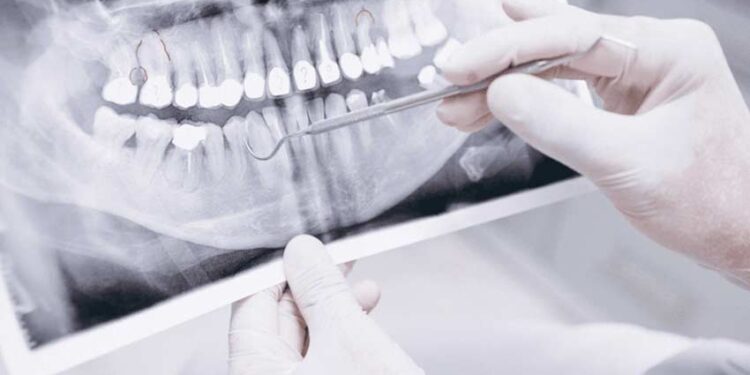 dental radiology